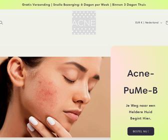 http://acne-pume-b.nl