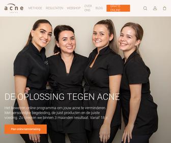 https://www.acneadvies.nl