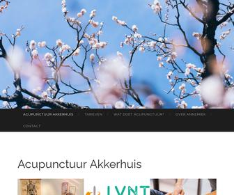 http://www.acupunctuurakkerhuis.nl