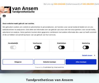 http://www.ansem-kunstgebitten.nl
