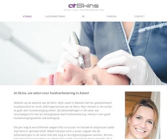 http://www.atskins.nl