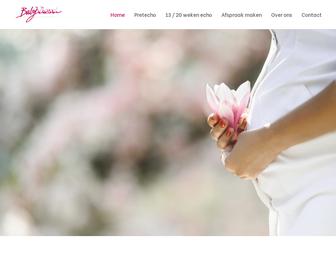 https://www.babyview.nl