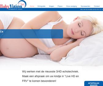 http://www.babyvision.nl