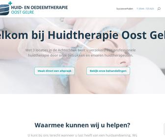 http://www.huidtherapieoostgelre.nl