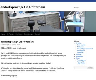 http://www.rotterdam.tandartspraktijk-lie.nl