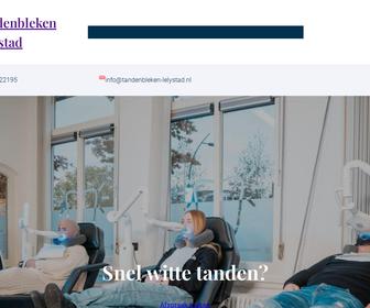 https://www.tandenbleken-lelystad.nl