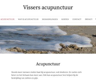 Vissers acupunctuur